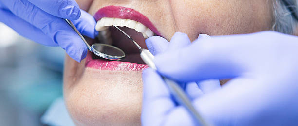 Best Emergency Tooth Extraction in Fayette, IA